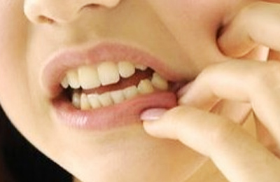 突發(fā)性、自發(fā)性的劇烈牙疼