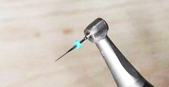 精細切割，極大程度保留牙神經(jīng)，根管治療成功率極高