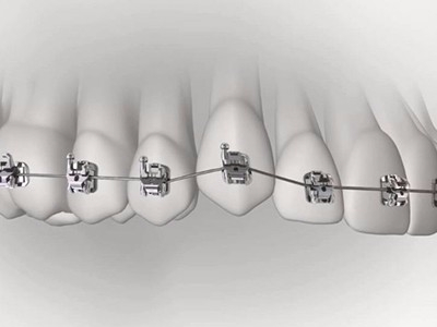 承德市哪家口腔醫(yī)院口腔正畸做得好？惟德口腔醫(yī)院來告訴您