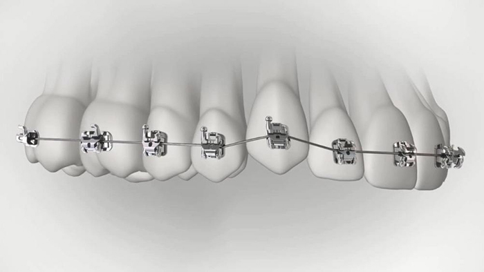 承德市哪家口腔醫(yī)院口腔正畸做得好？惟德口腔醫(yī)院來告訴您