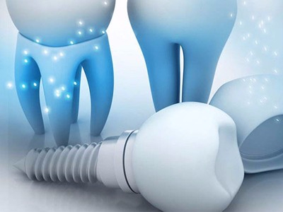 2020承德?lián)Q半口牙大概多少錢