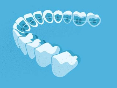 惟德口腔醫(yī)院口腔正畸好不好？